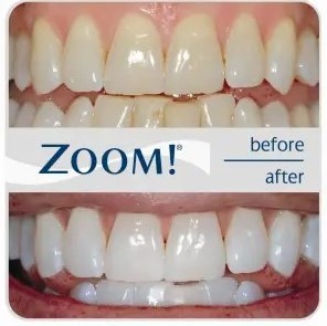 ABUIABACGAAg7-CBwgYo4q-A2gYwqAI4pwI