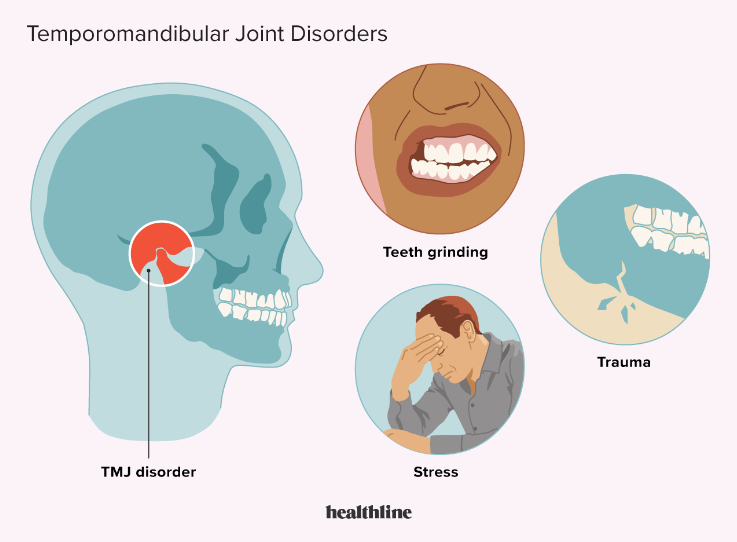 ABUIABAEGAAgyoKXwwYo7IyNtwQw4QU4ngQ
